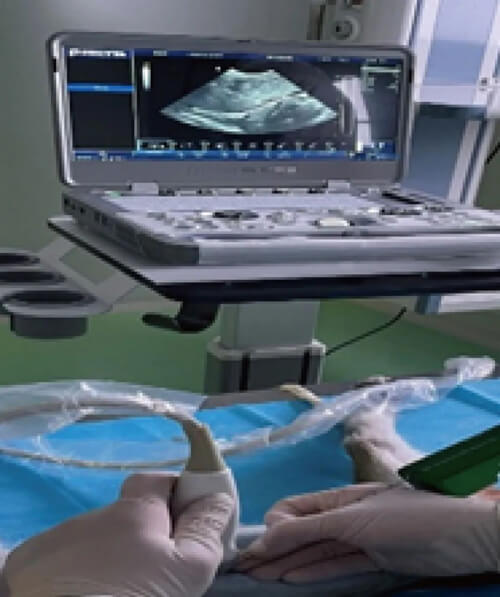 12-beats365DMPK部门开展食蟹猴肝脏穿刺活检用于PK-PD研究.jpg 12-beats365DMPK部门开展食蟹猴肝脏穿刺活检用于PK-PD研究.jpg