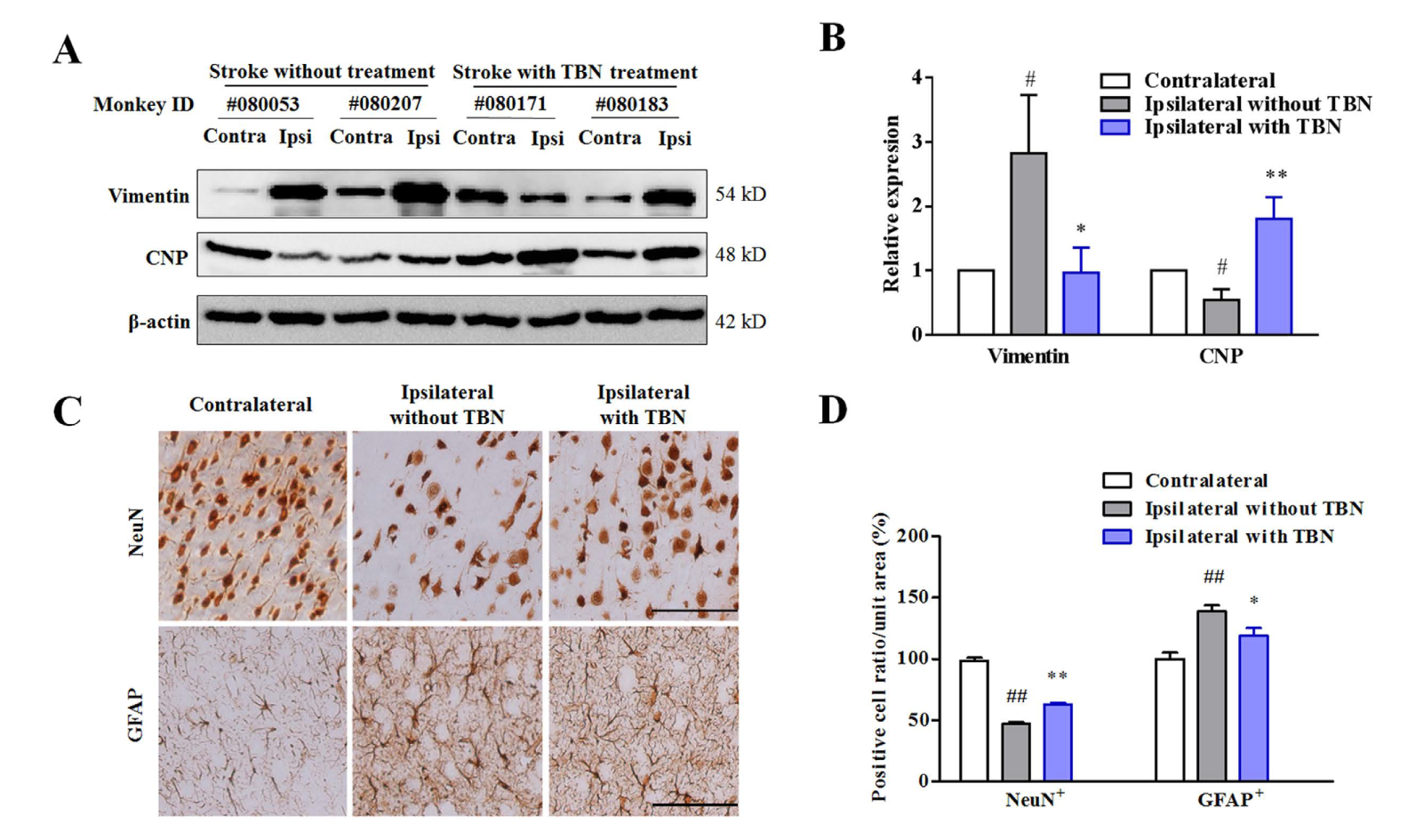TBN是一种治疗缺血性卒中的新型临床候选药物，本研究中TBN通过beats365合成